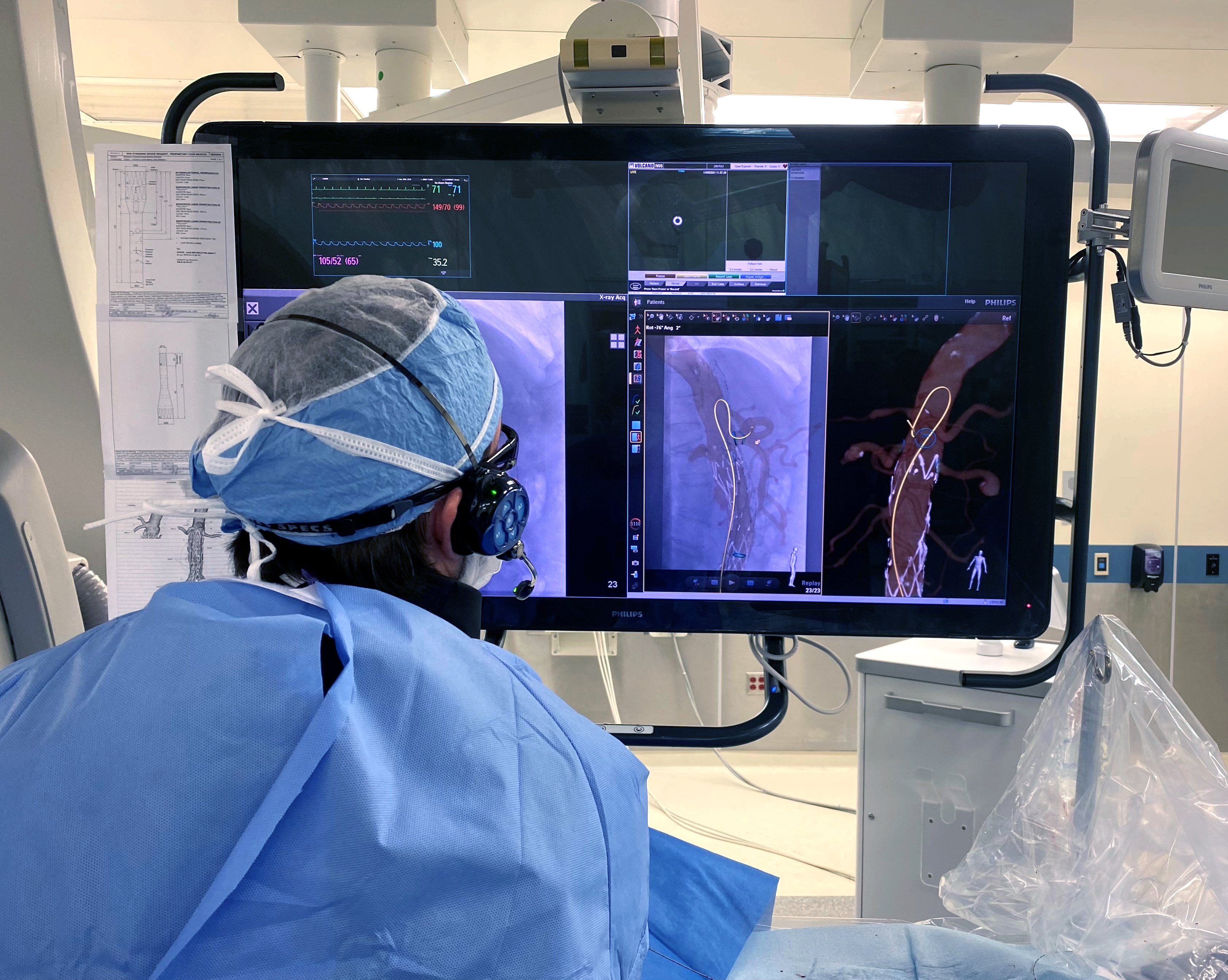 Philips is making its LumiGuide system available to specialized hospitals in Europe and the U.S. The system is guided by light rather than x-ray for complex aortic procedures. Image courtesy of Philips.
