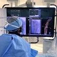 Philips is making its LumiGuide system available to specialized hospitals in Europe and the U.S. The system is guided by light rather than x-ray for complex aortic procedures. Image courtesy of Philips.