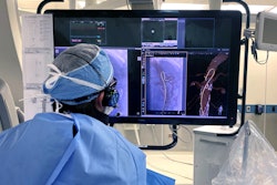 Philips is making its LumiGuide system available to specialized hospitals in Europe and the U.S. The system is guided by light rather than x-ray for complex aortic procedures. Image courtesy of Philips.
