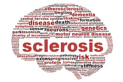 Multiple Sclerosis