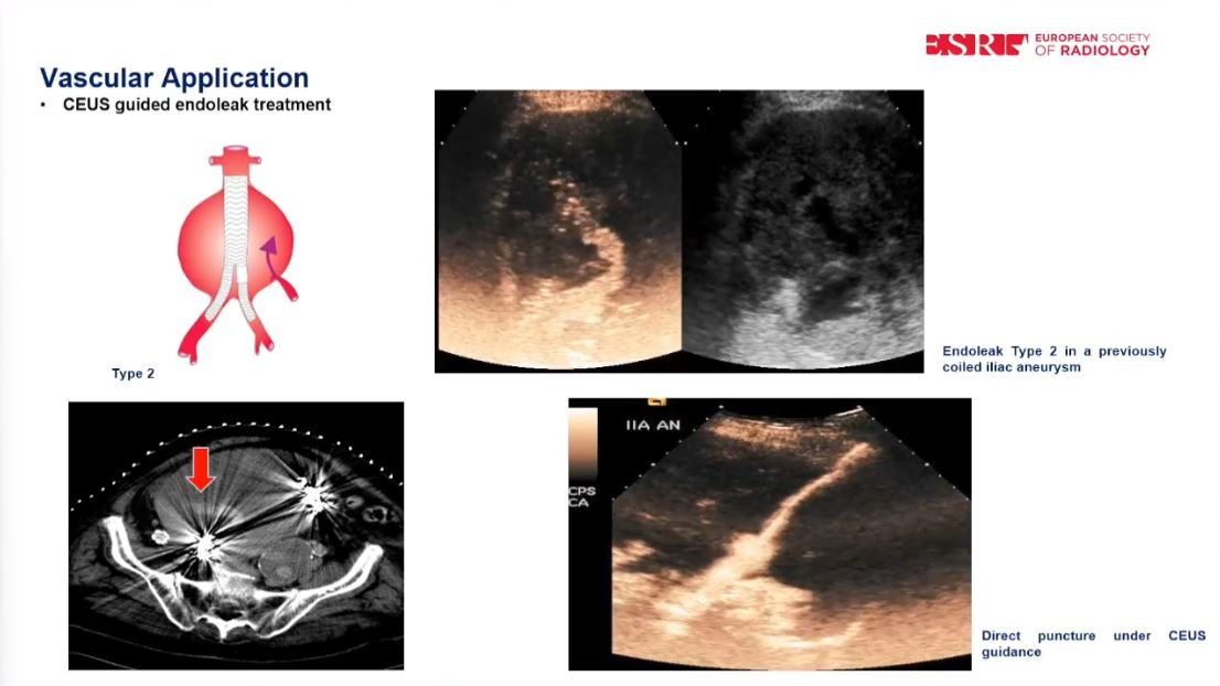 2024 03 11 Ecr Ceus Thumbnail