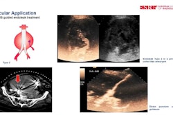 2024 03 11 Ecr Ceus Thumbnail