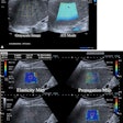 2024 03 19 Radiology Ultrasound Liver