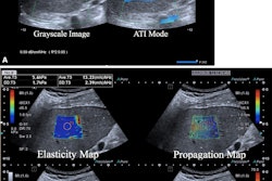 2024 03 19 Radiology Ultrasound Liver