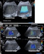 2024 03 19 Radiology Ultrasound Liver