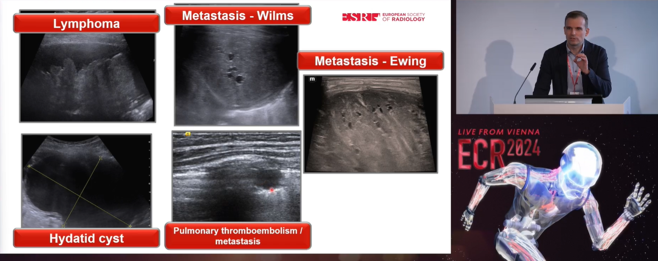 Jovan Lovrenski, MD, PhD, from the University of Novi Sad in Serbia explains the diverse use of lung ultrasound in pediatric imaging in an ECR 2024 presentation.