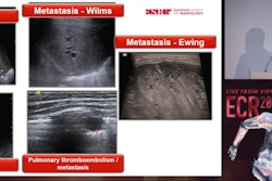 Jovan Lovrenski, MD, PhD, from the University of Novi Sad in Serbia explains the diverse use of lung ultrasound in pediatric imaging in an ECR 2024 presentation.