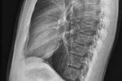 Chest X Ray Lateral View