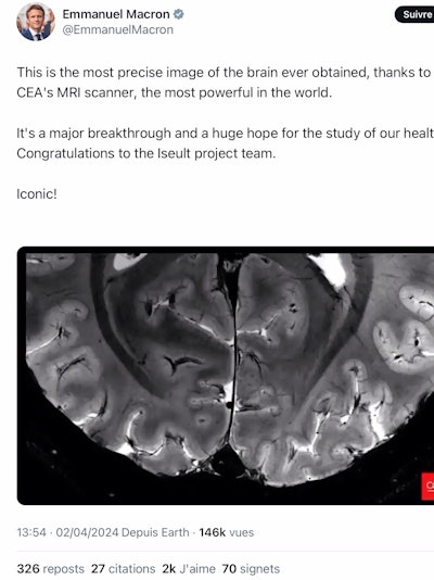 President Emmanuel Macron offered his congratulations to the research team on social media on 2 April.