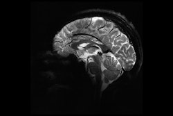 Sagittal view of the brain at 11.7 tesla makes it possible to visualize the cerebellum in very fine detail.