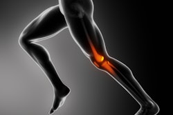 Running Knee Pain