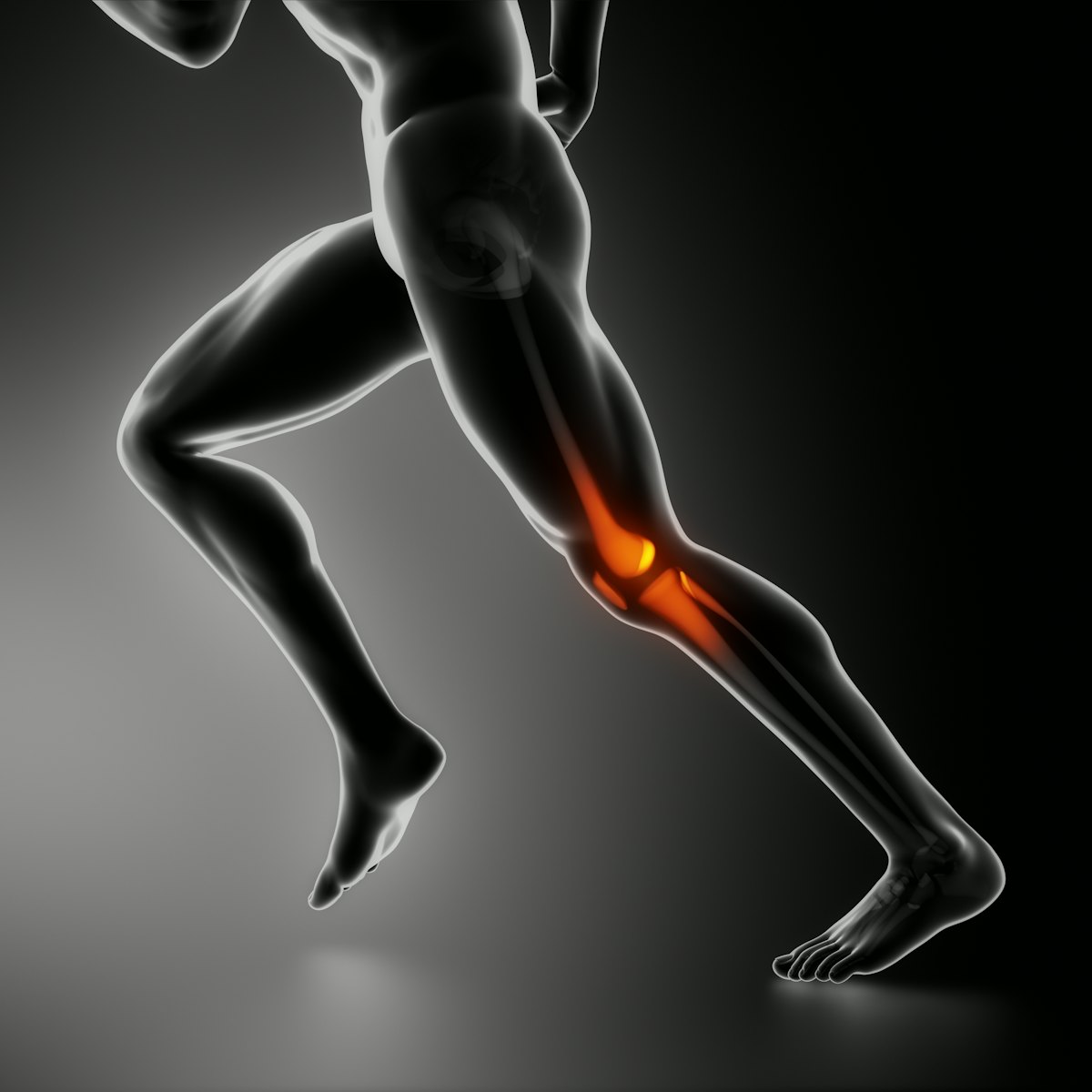 Риск развития остеоартрита коленного сустава может зависеть от мышечной массы