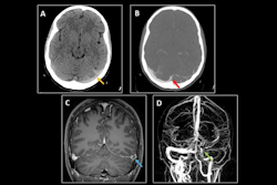 2024 05 02 Ct Insider Figure 18 Resized Thumb