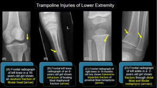 Image courtesy of the ARRS.