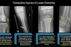 Image courtesy of the ARRS.