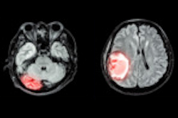 Mri Brain Disease Montage Thumb