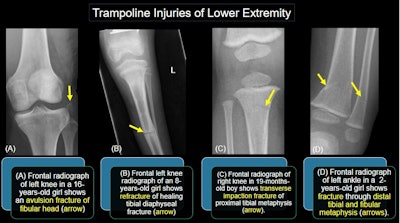 Image courtesy of the ARRS.