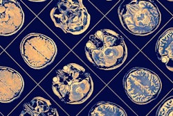 Mri Brain Social