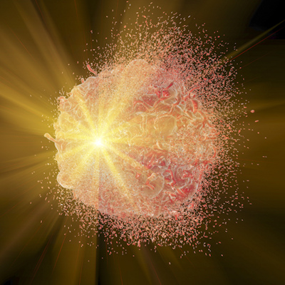 Radiotherapy 400 (1)