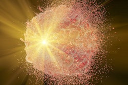 Radiotherapy 400 (1)