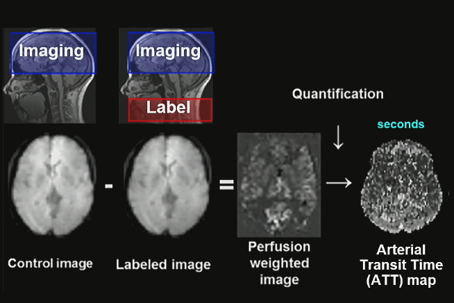 Studying White Matter Hemodynamics Ismrm2024