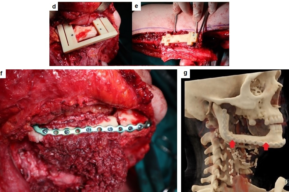 2024 06 07 Ad Viz Fig 3 Thumb