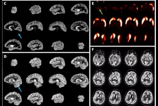 2024 Ioty 666702eaea203 Thumb