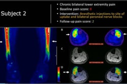 Pet Mri Pain 666b490437450 (1)