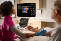A Clinician Using Next Generation Epiq Elite Vm10 With A Patient Ali Global