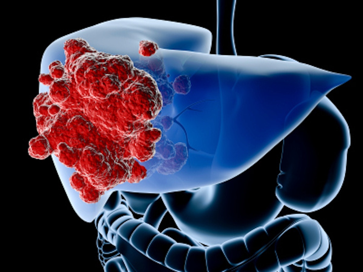 Dutch team shines light on treatment of liver metastases