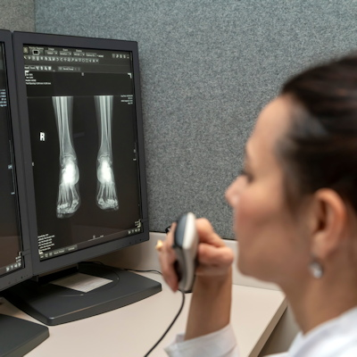 Radiologist Computer Screen X Ray 400