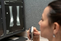 Radiologist Computer Screen X Ray 400