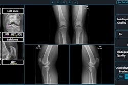 2024 07 10 Koa Knee