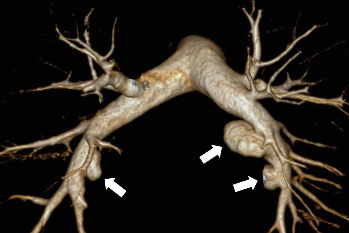 2024 07 25 Ame Wom Insider Figure 6 Image B Thumb