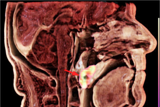 3 D Pet Mri 668590e65065f