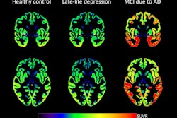 Tau Depressed 66a16540ee0a1