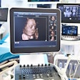 Ultrasound 3 D Fetal Head