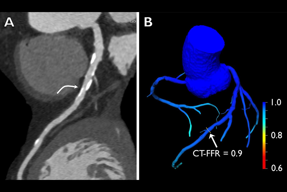 2024 08 20 Radiology Soschynski Thumbnail