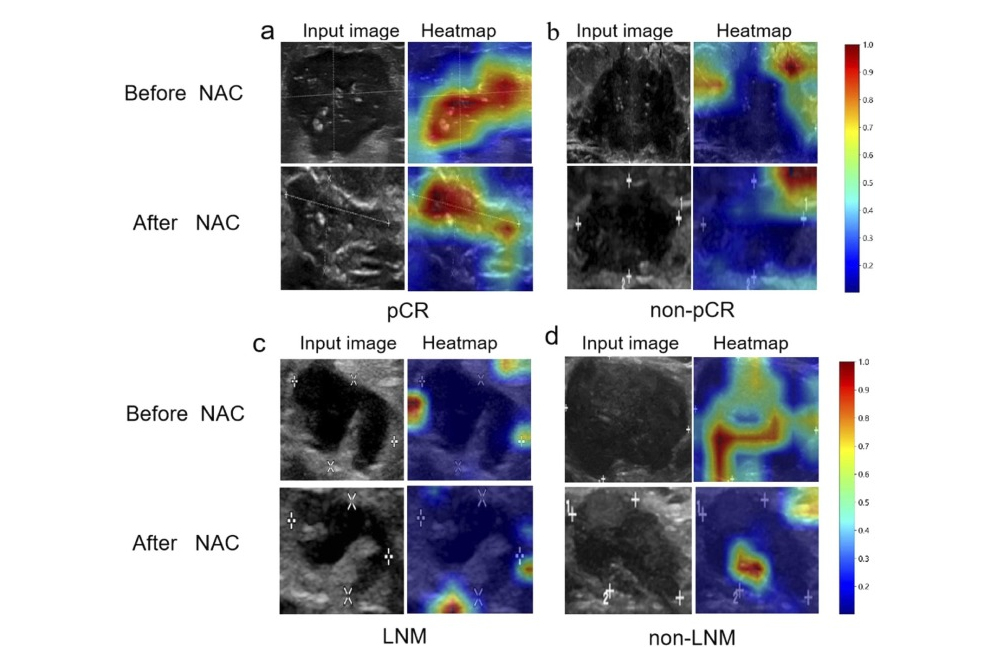 2024 08 24 Academic Rad Ultrasound Ai Model Thumbnail