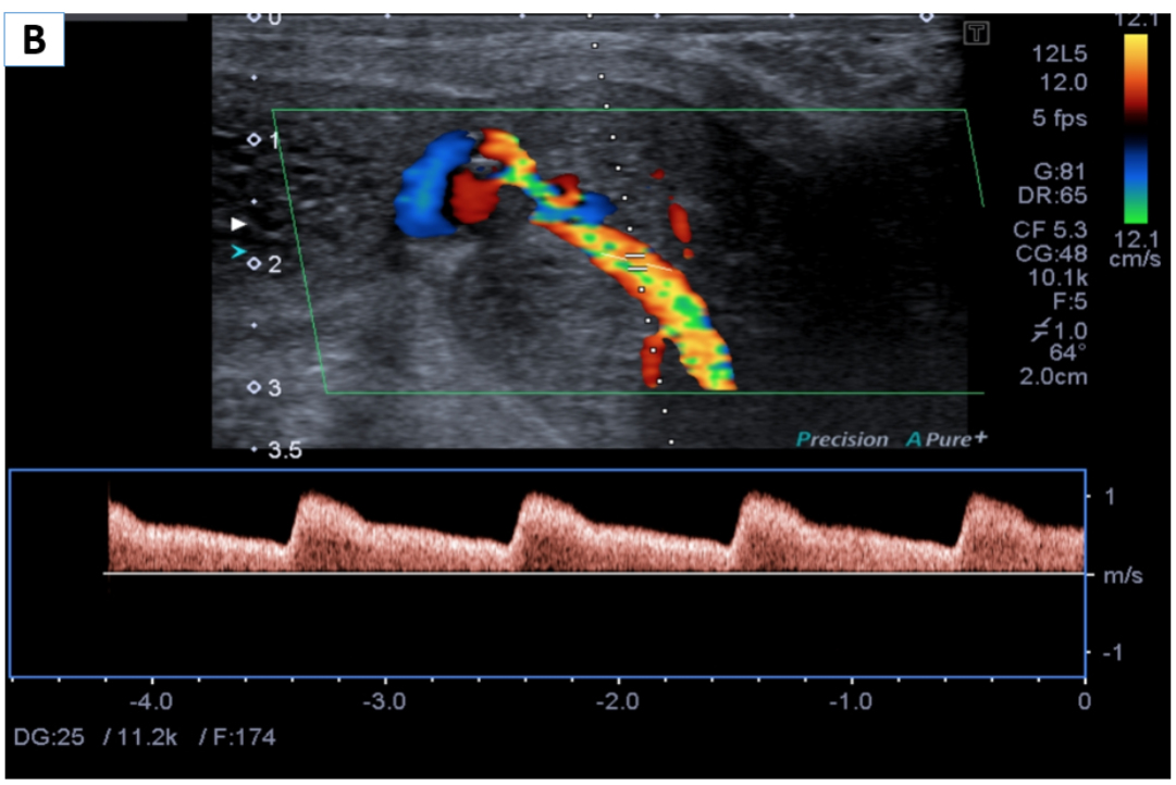 2024 08 29 Ultrasound Insider Figure 10 Image B
