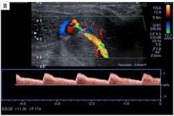 2024 08 29 Ultrasound Insider Figure 10 Image B
