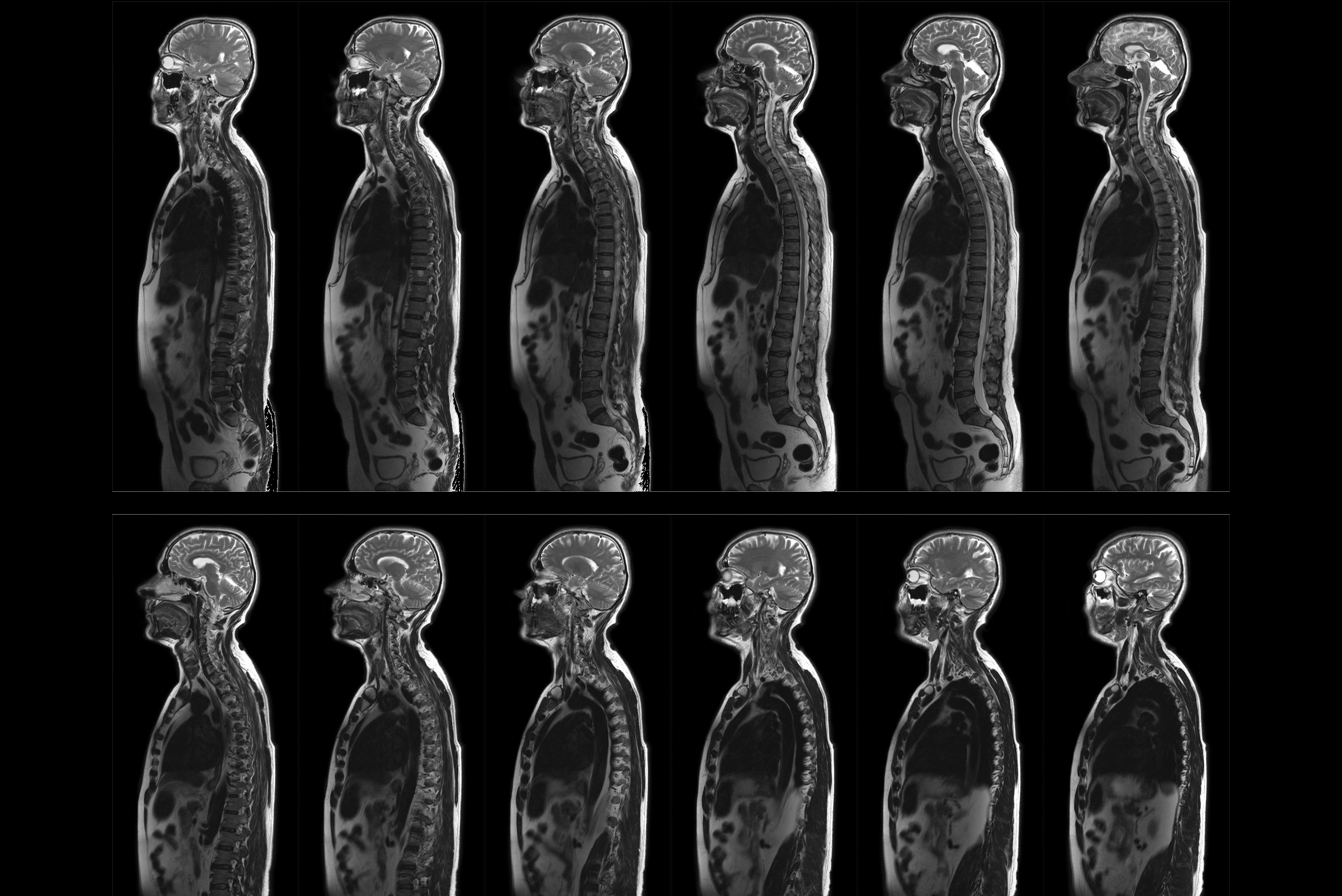 Mri Scan Complete Thumbnail