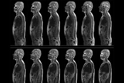 Mri Scan Complete Thumbnail