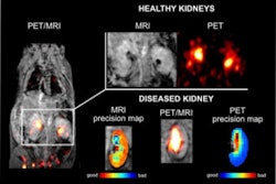 Pet Mri Agent