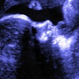 Fetal Ultrasound Social