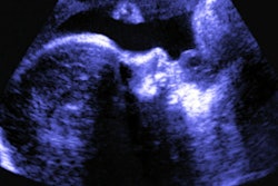 Fetal Ultrasound Social