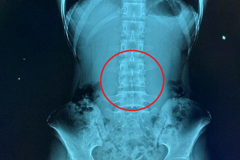 2024 09 12 Digital X Ray Insider Figure 7 Thumbnail