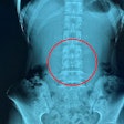2024 09 12 Digital X Ray Insider Figure 7 Thumbnail