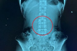 2024 09 12 Digital X Ray Insider Figure 7 Thumbnail