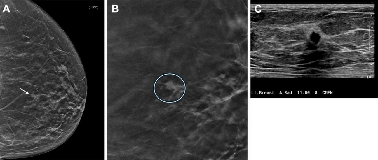 2024 09 17 Radiology Dbt
